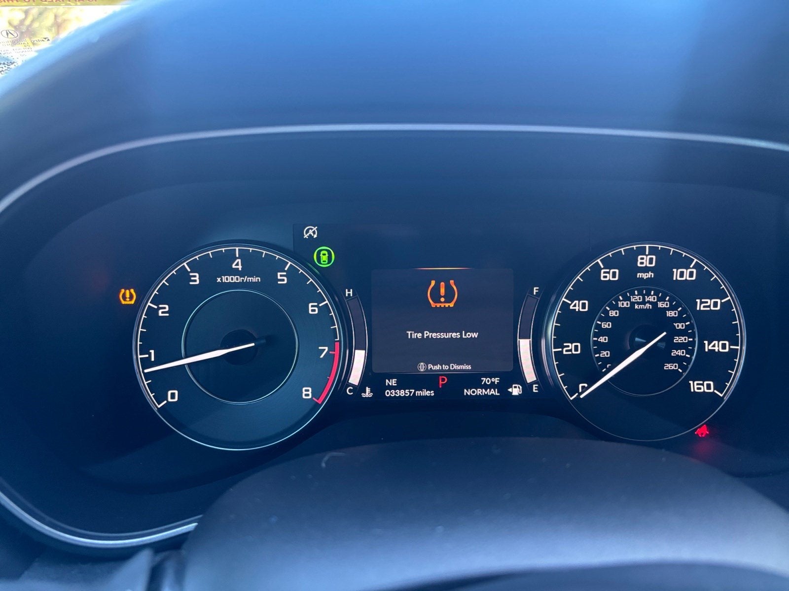 2021 Acura TLX Advance